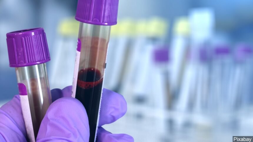 HIV Blood testing logo_Pixabay
