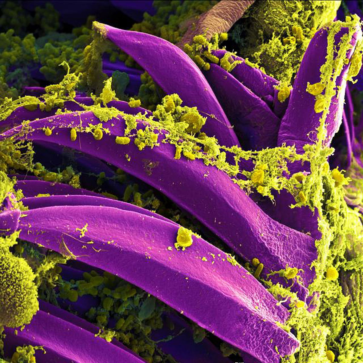 <i>National Institute of Allergy and Infectious Diseases</i><br/>Produced by the National Institute of Allergy and Infectious Diseases (NIAID)