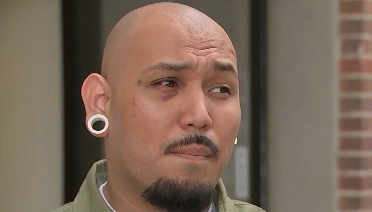 <i>KABC</i><br/>Diamond Gonzalez said he and his friends were leaving the bar when they were suddenly attacked in the parking lot.