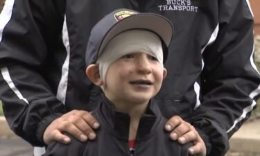 A 6-year-old Connecticut boy who suffered burns to his face and leg has been released from the hospital.