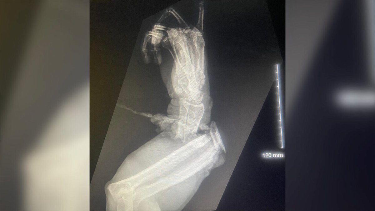 <i>Courtesy of Floria Gator Gardens</i><br/>X-ray image shows the damage to Graziani's arm