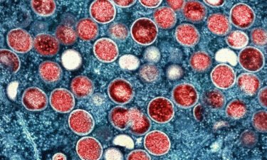 This image shows a colorized transmission electron micrograph of monkeypox particles (red). The WHO says that the first possible case of human-to-dog monkeypox transmission is 'not surprising.'