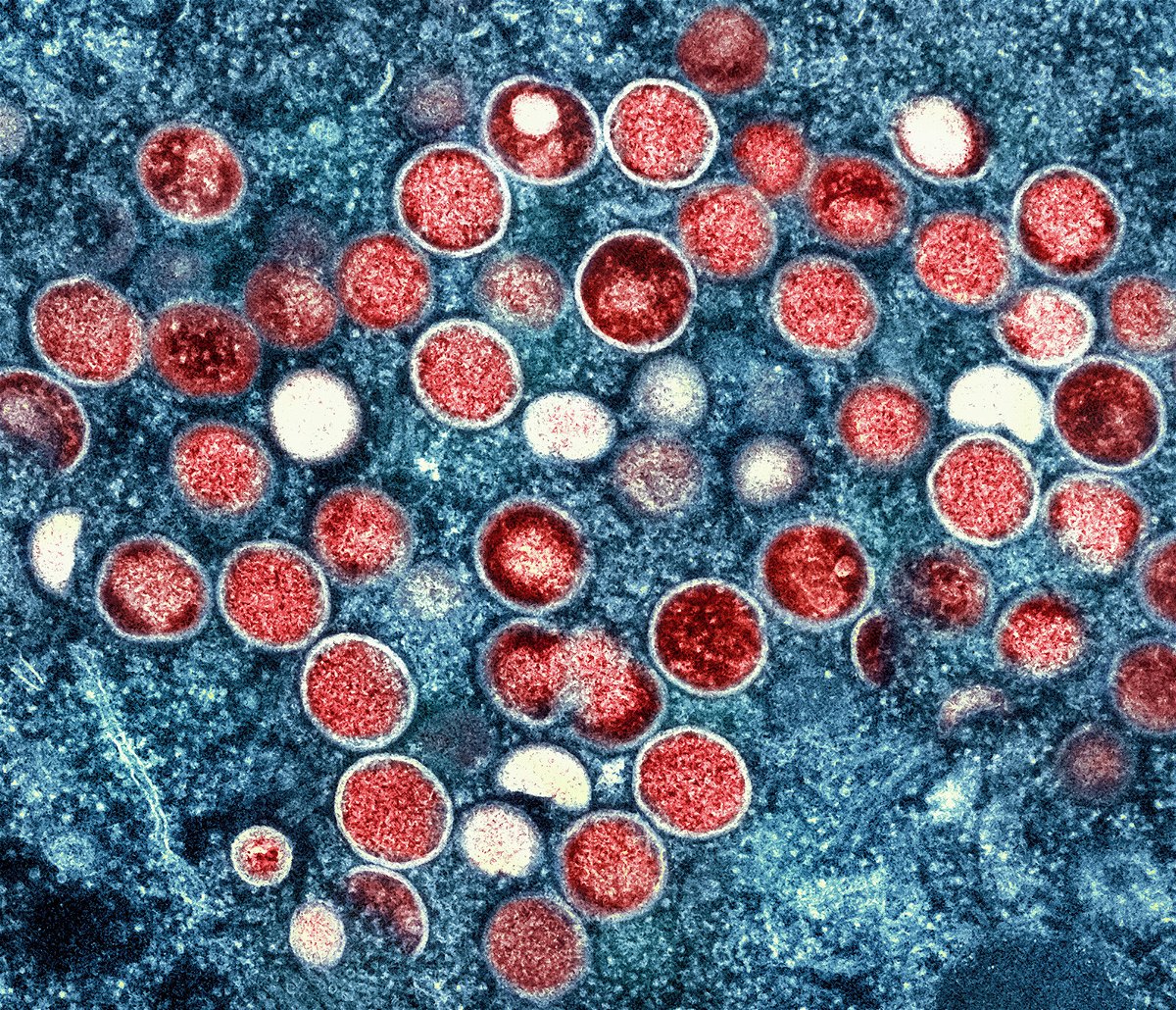 <i>NIAID/AP</i><br/>This image shows a colorized transmission electron micrograph of monkeypox particles (red). The WHO says that the first possible case of human-to-dog monkeypox transmission is 'not surprising.'