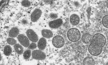 The World Health Organization renames monkeypox as "mpox" on Monday. Pictured is an undated microscopic image of the Monkeypox virus.