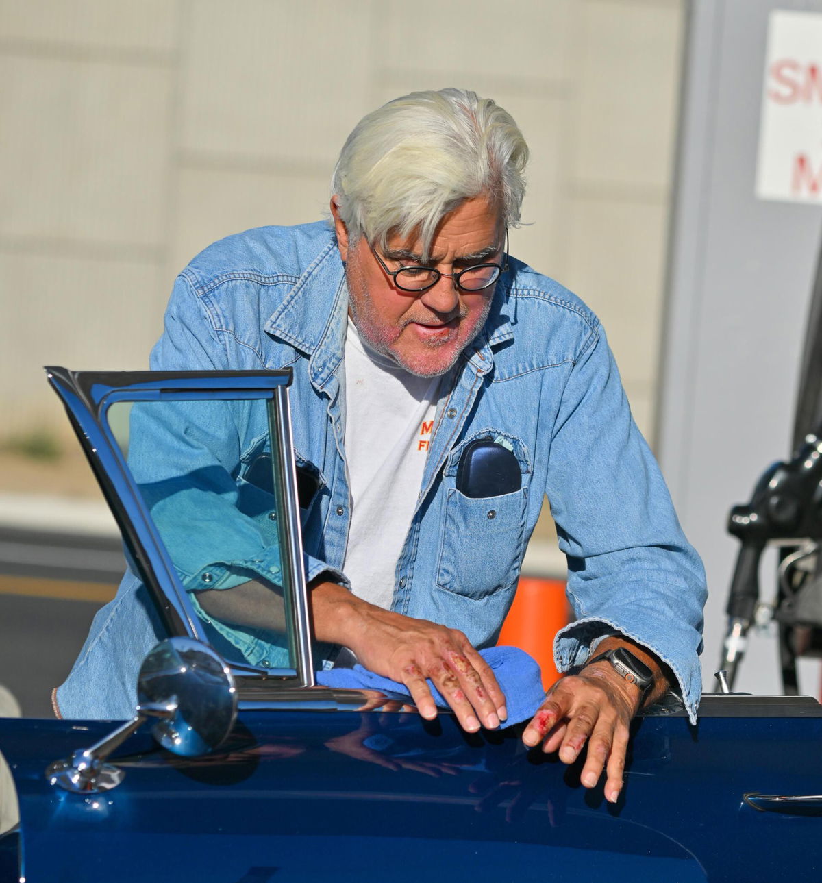 Jay Leno Performing At California Comedy Club, Two Weeks After Burn ...