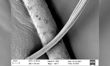 This image shows a possible canine hair from the grave viewed beneath an electron microscope.