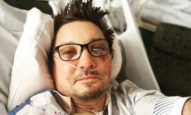 An image posted to Renner's Instagram account shows the actor in what appears to be a hospital bed with facial injuries.