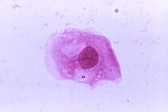 <i>CDC/James Volk</i><br/>The bacterium Neisseria meningitidis is shown. It spreads when people in close contact share saliva or spit.