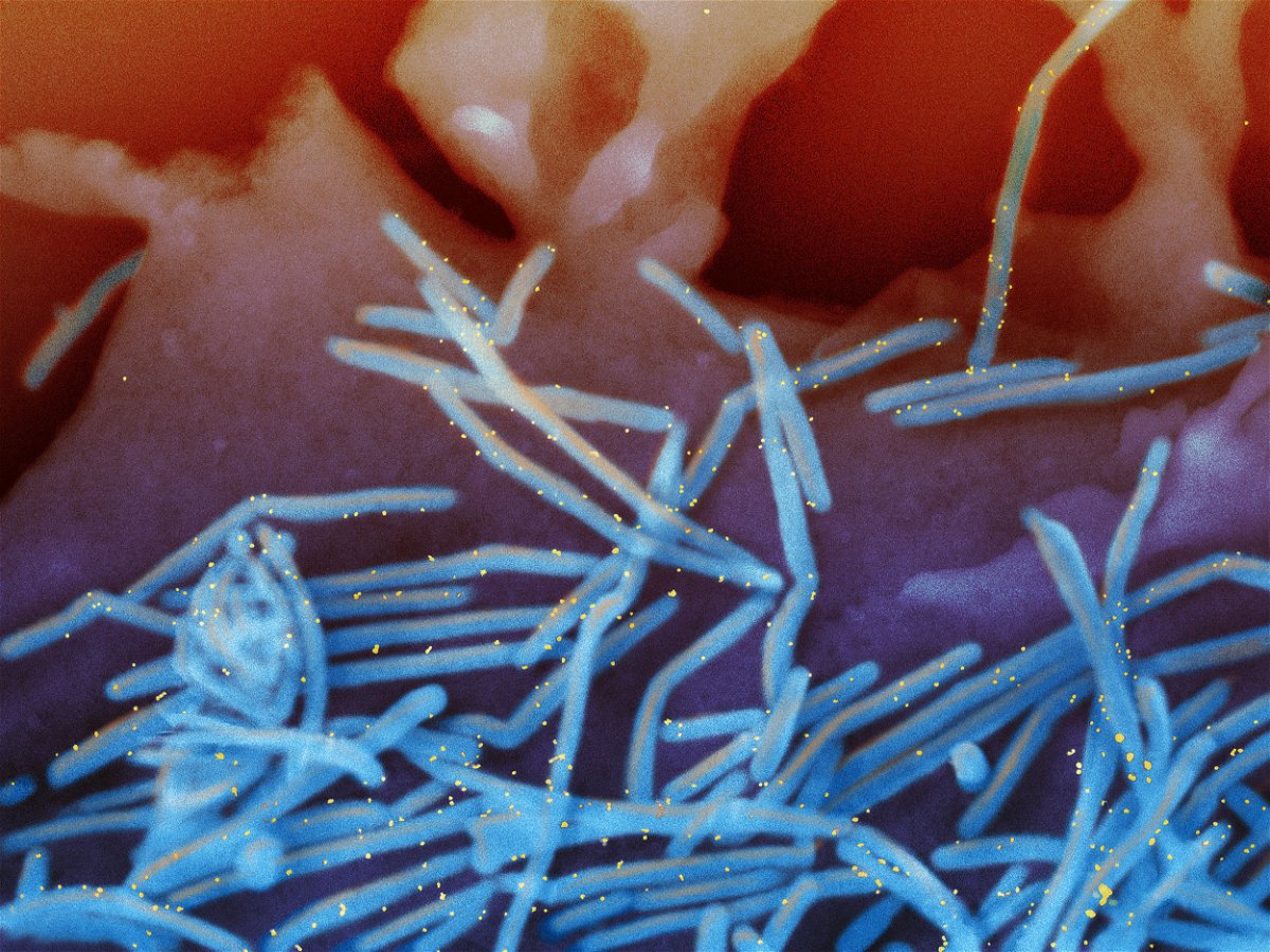 <i>NIAID</i><br/>Scanning electron micrograph of human respiratory syncytial virus (RSV) virions (colorized blue) that are labeled with anti-RSV F protein/gold antibodies (colorized yellow) shedding from the surface of human lung epithelial A549 cells.