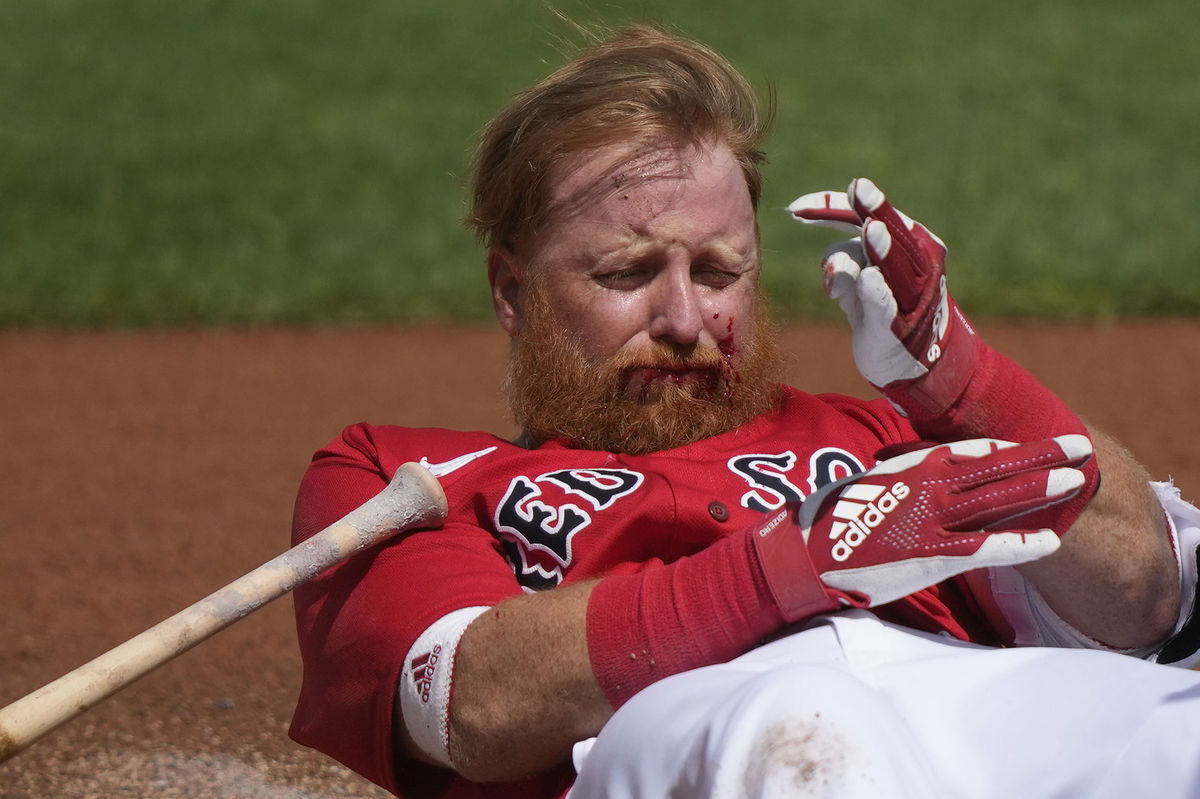 <i>Gerald Herbert/AP</i><br/>Boston Red Sox third baseman Justin Turner reacts after being hit in the face by a pitch by Detroit Tigers pitcher Matt Manning in the first inning.