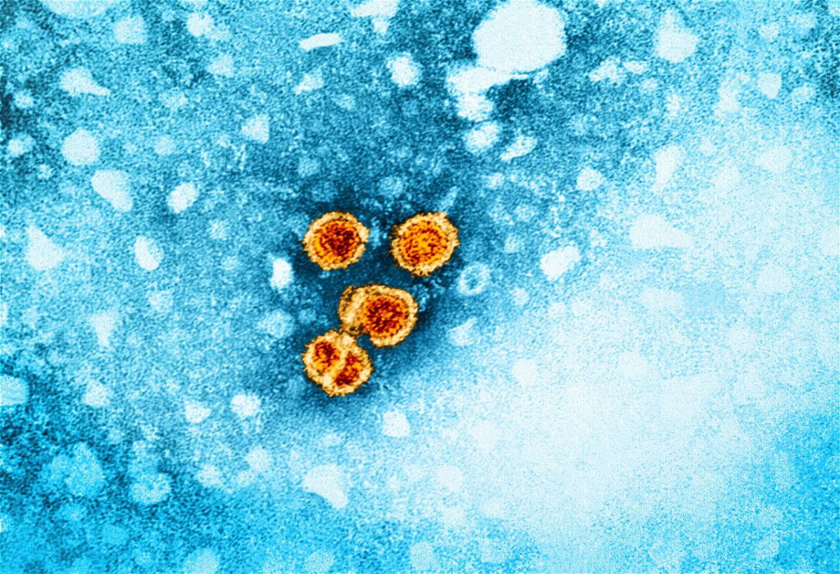 <i>NIAID/CDC</i><br/>The US Centers for Disease Control and Prevention says all adults should be screened for hepatitis B.
