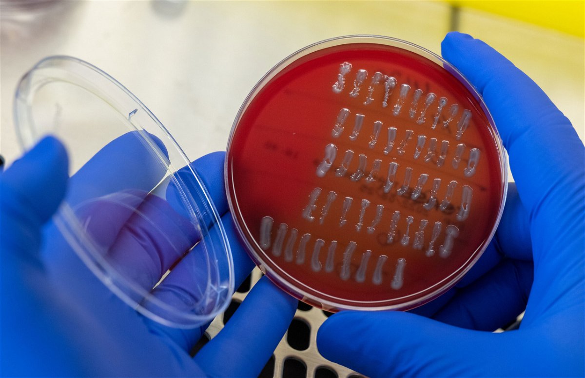 <i>Hendrik Schmidt/picture alliance/dpa/Getty Images</i><br/>Researchers have long known of a link between E. coli and UTIs