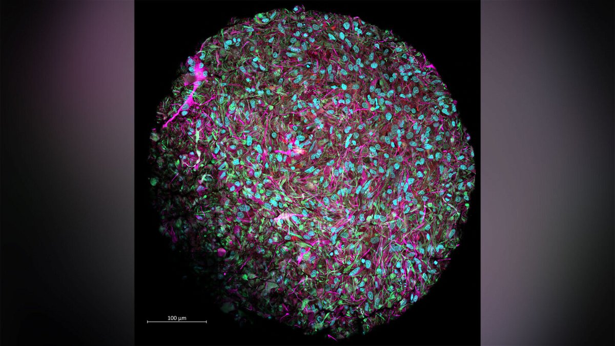 <i>Courtesy Jesse Plotkin/Johns Hopkins University</i><br/>This magnified image shows a brain organoid produced in Hartung's lab. The culture was dyed to show neurons in magenta