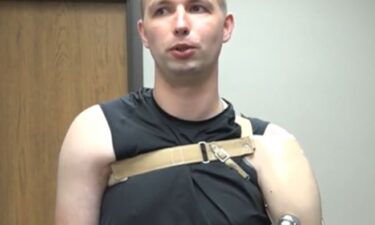 Andriy Mazuryk lost his left arm while trying to help his fellow soldiers on the battlefield. But nearly one year later Mazuryk received a prosthetic arm in Livonia