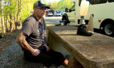 William Baker is working to reunite a lost prosthesis with its rightful owner.