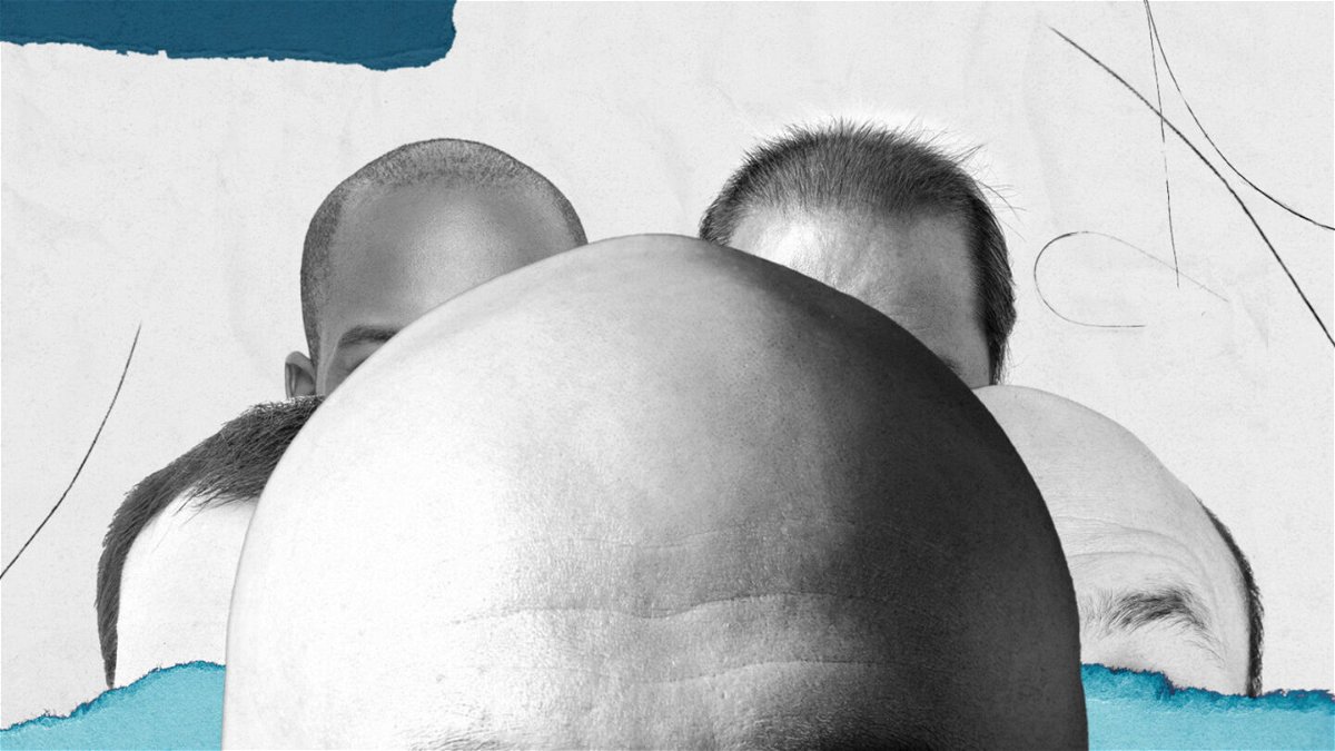 <i>Leah Abucayan/Getty</i><br/>There are three important days in every bald(ing) man's life. Growing bald gracefully is about reducing the gap between these milestones as far as possible.