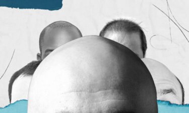 There are three important days in every bald(ing) man's life. Growing bald gracefully is about reducing the gap between these milestones as far as possible.