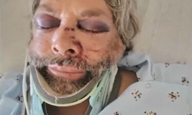 54-year-old Carlos Ayala was paving a parking lot at a Garden Grove shopping center when he was viciously attacked after he told a group of people not to walk on the asphalt