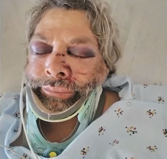 <i>Sara Ayala/KABC</i><br/>54-year-old Carlos Ayala was paving a parking lot at a Garden Grove shopping center when he was viciously attacked after he told a group of people not to walk on the asphalt