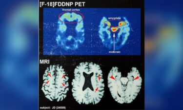 The Concussion in Sport Group