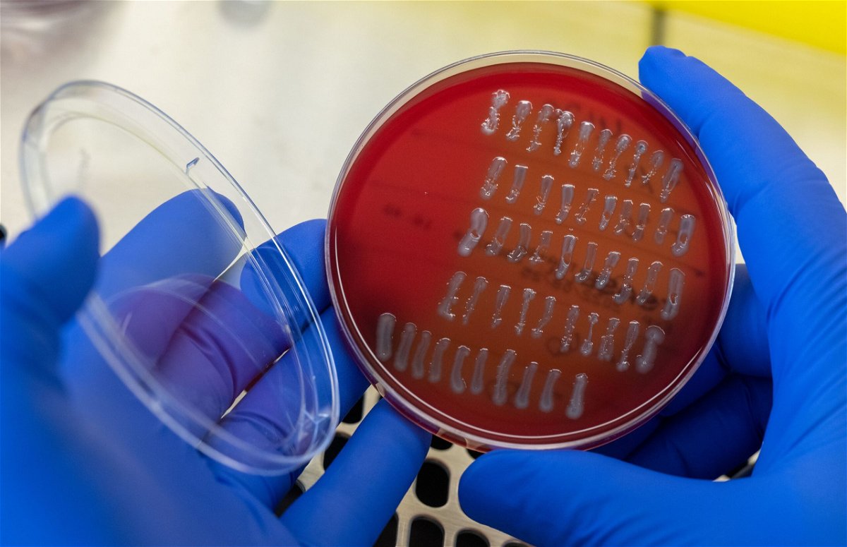 <i>Hendrik Schmidt/picture alliance/Getty Images</i><br/>A medical-technical assistant prepares E-coli strains for analysis.