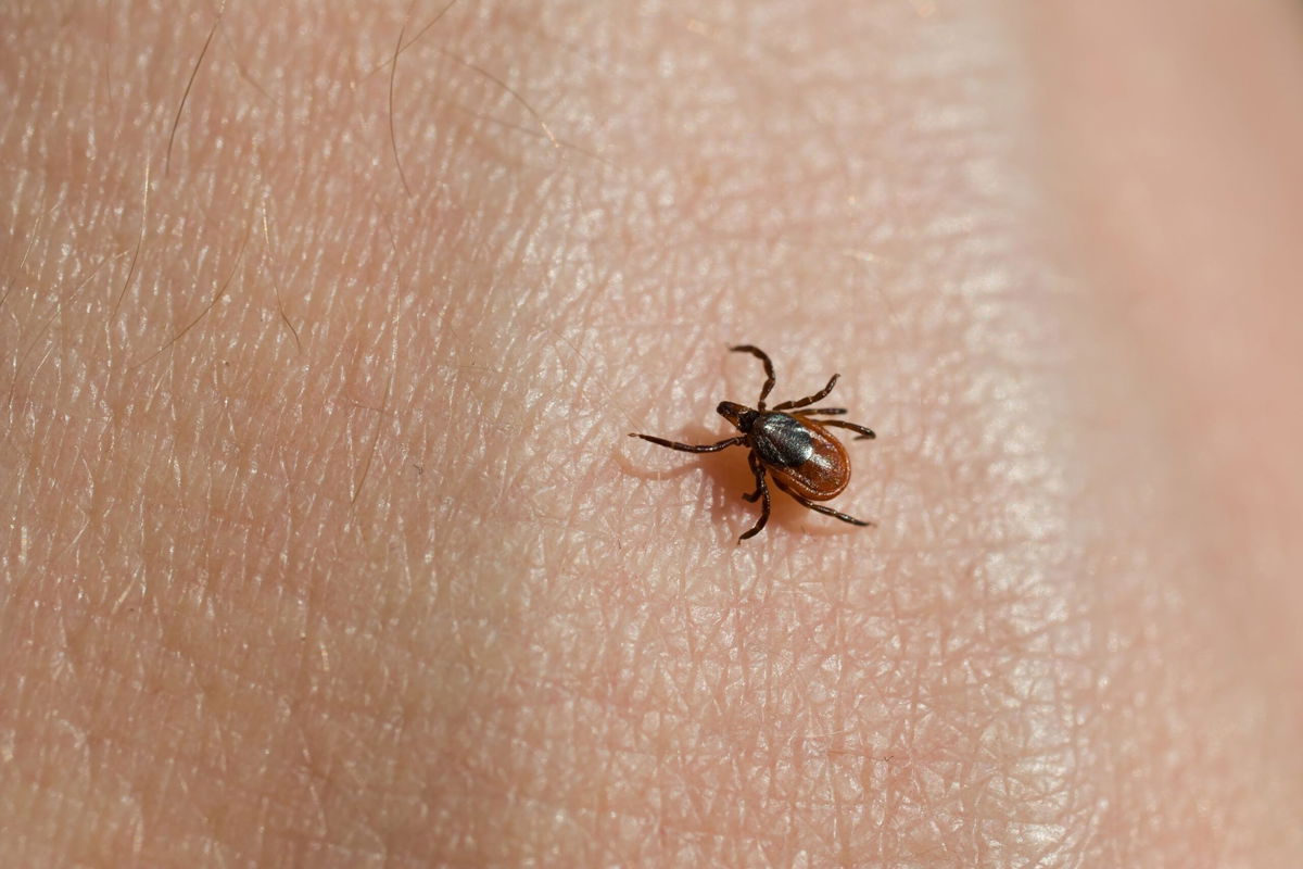 <i>Yuzyra/iStockphoto/Getty Images</i><br/>Blacklegged or deer ticks are 
