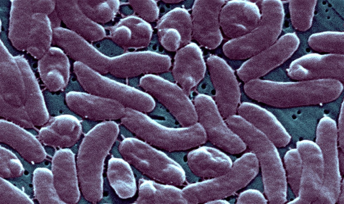 <i>BSIP/Universal Images Group/Getty Images</i><br/>Vibrio vulnificus lives in warm