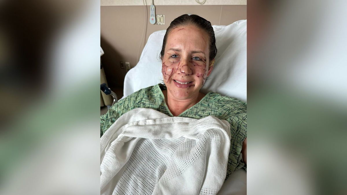 <i>Jen Royce</i><br/>Jen Royce was one of the three women who were attacked by an otter along the Jefferson River in Montana.