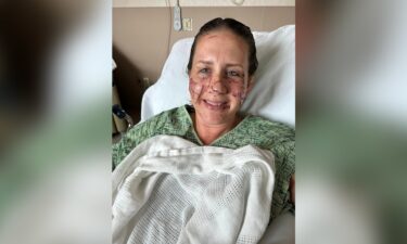 Jen Royce was one of the three women who were attacked by an otter along the Jefferson River in Montana.