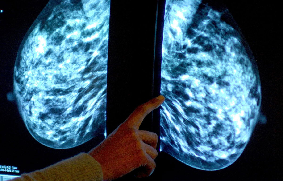 For women over the age of 75, there is no guidance on whether to continue getting mammograms, according to the US Preventive Services Task Force.