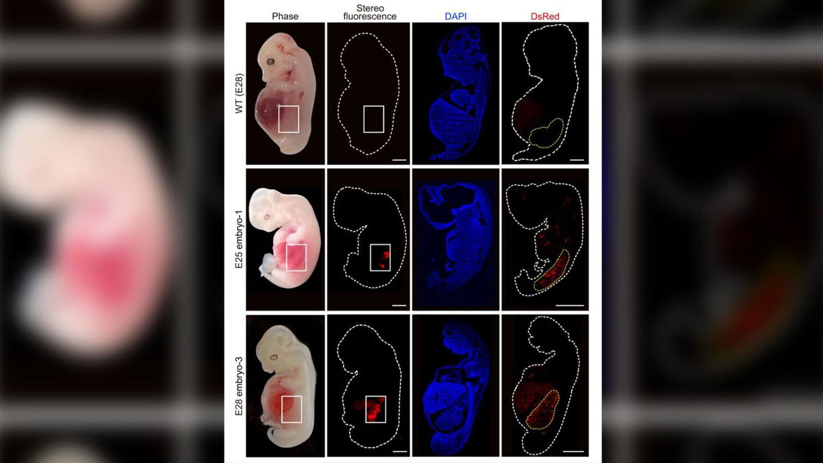 Scientists have grown kidneys containing mostly human cells inside pig embryos. Humanized kidney cells inside a pig embryo are shown in red.