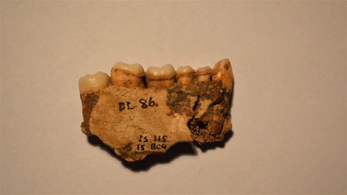 Dental plaque can reveal a lot about ancient diets.