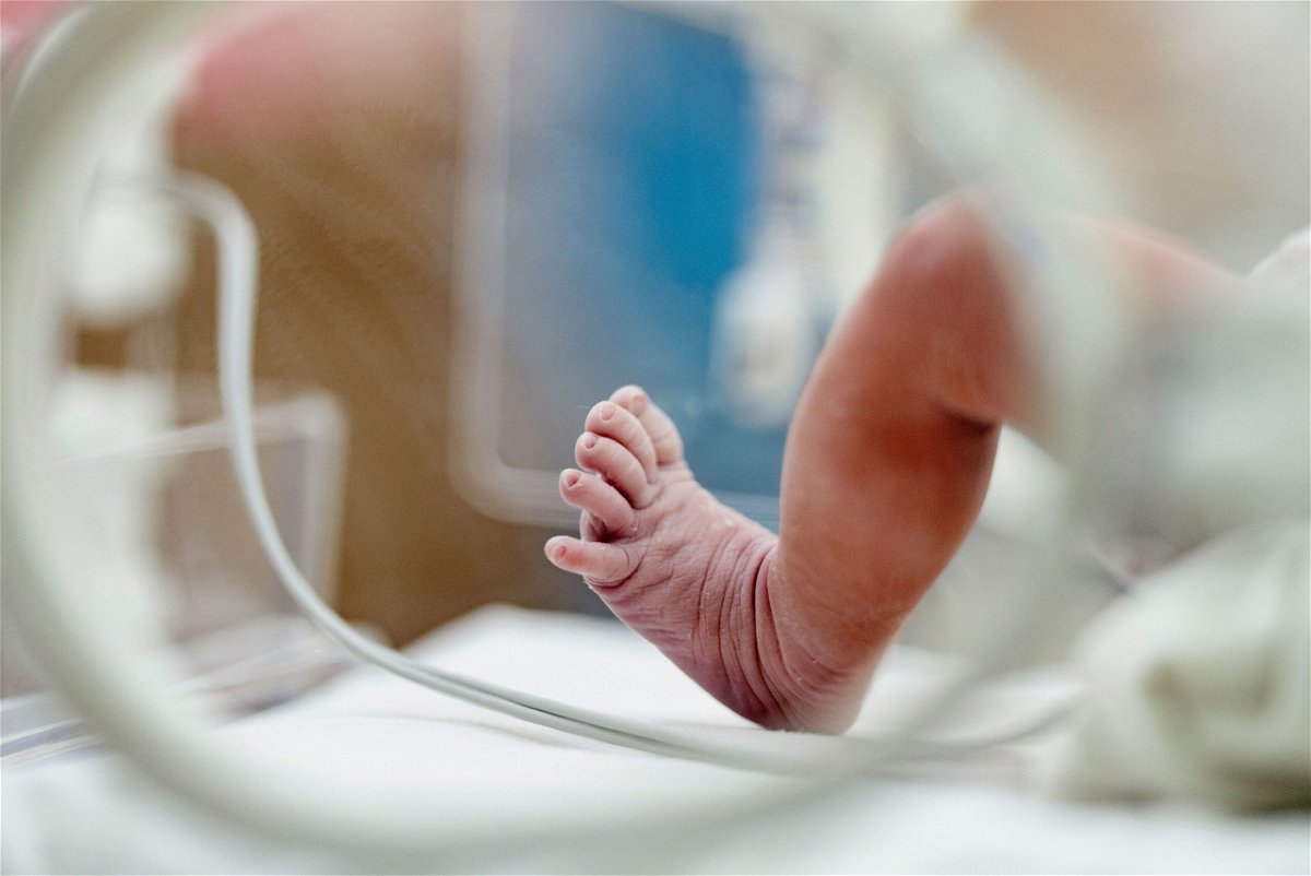 A new March of Dimes report says the US preterm birth rate was 10.4% in 2022, down only 1% from 2021’s rate, which was the highest in more than a decade.