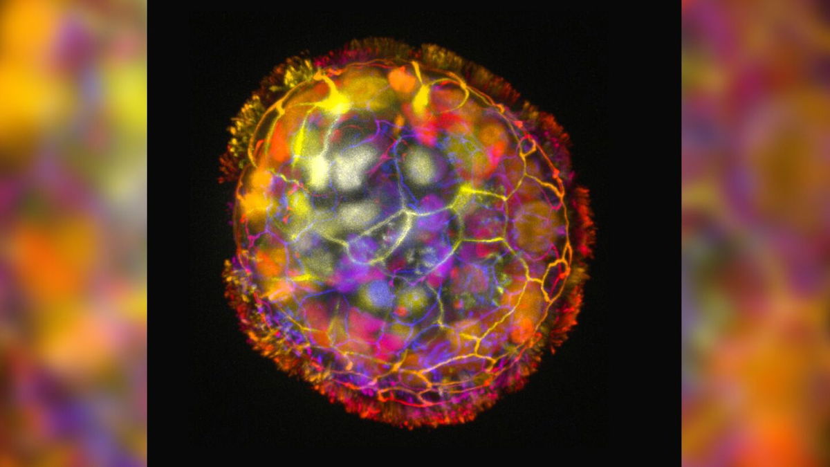 A colored image shows the multicellular structure of an anthrobot, surrounded by cilia on its surface, enabling it to move and explore its environment.