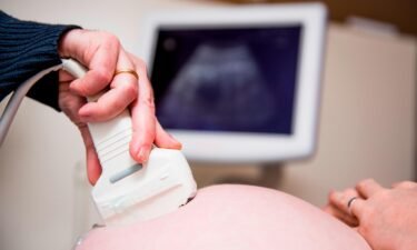 Illustration picture shows a doctor doing a ultrasound examination during a visit of a pregnant woman to her gynaecologist