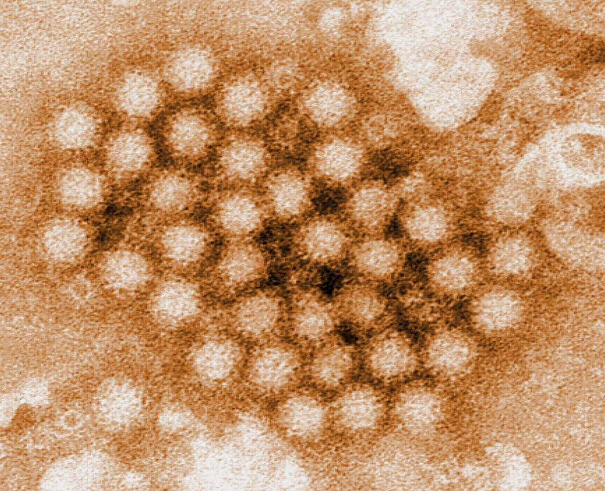 This digitally-colorized, transmission electron microscopic (TEM) image, revealed some of the ultrastructural morphology displayed by a cluster of norovirus virions, or virus particles.