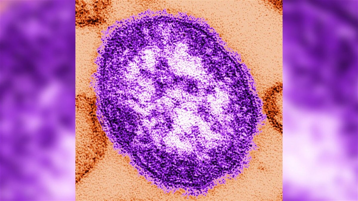 <i>CDC via CNN Newsource</i><br/>Measles is a vaccine-preventable