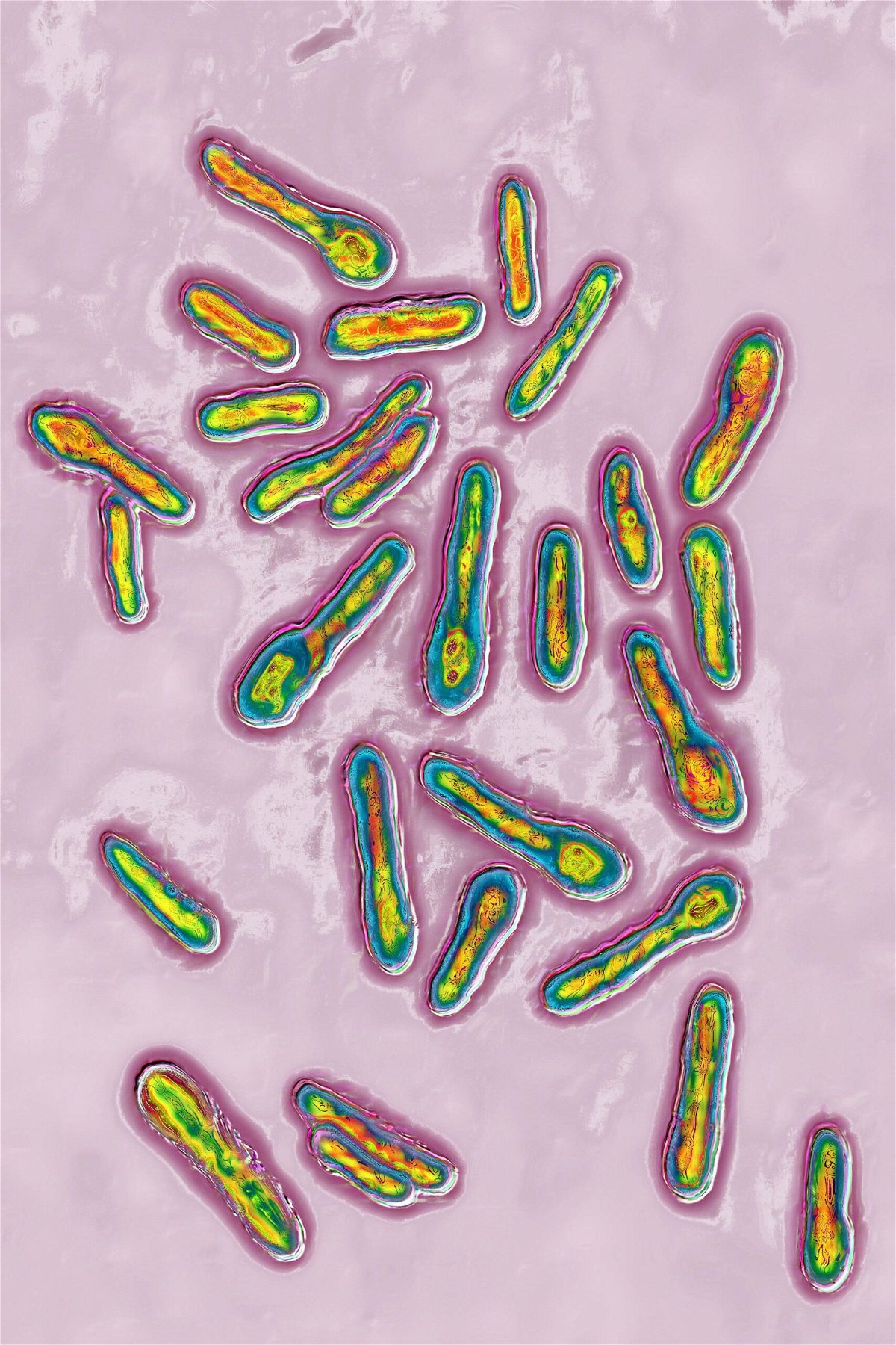 An image produced using optical microscopy shows Clostridium botulinum, an ingredient in Botox and similar cosmetic substances. The purified form of the botulinum toxin is approved by the FDA for use by licensed healthcare providers as a cosmetic treatment.