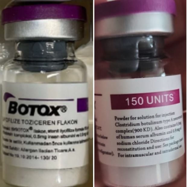 The US Food and Drug Administration is warning that dangerous counterfeit versions of Botox have been identified in multiple states, putting the safety of consumers at risk.
