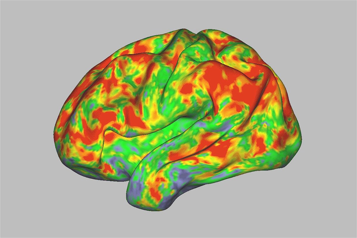 <i>Sara Moser/Washington University School of Medicine via CNN Newsource</i><br/>This brain on psilocybin is at the peak of activity