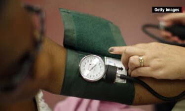 A new study found that having your arm in the wrong position during blood pressure checks — either at home or the doctor’s office — can result in readings “markedly higher” than when your arm is in the recommended position.