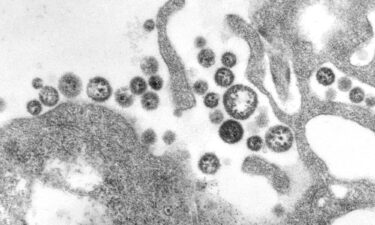 A resident of eastern Iowa who had recently traveled to West Africa died after catching Lassa fever