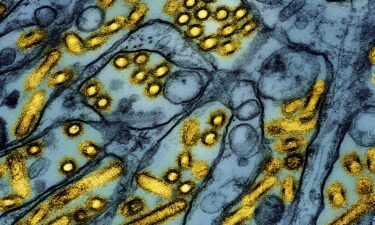 The California Department of Public Health is reporting a child is recovering after possible case of bird flu.