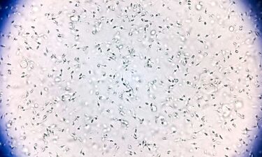 Sperm from the donor was used to conceive at least 67 children from 46 families.