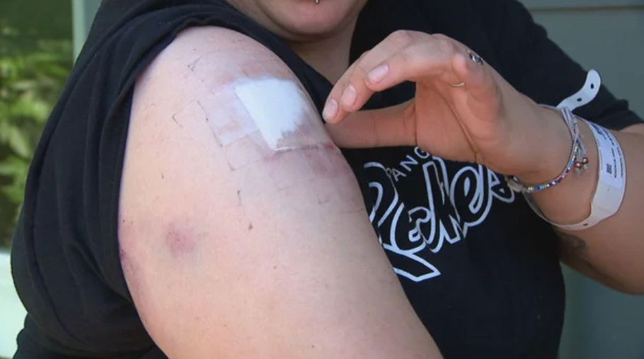<i>KCNC via CNN Newsource</i><br/>A Colorado mom is worried and angry after she was struck by a stray bullet while inside her home in Aurora.